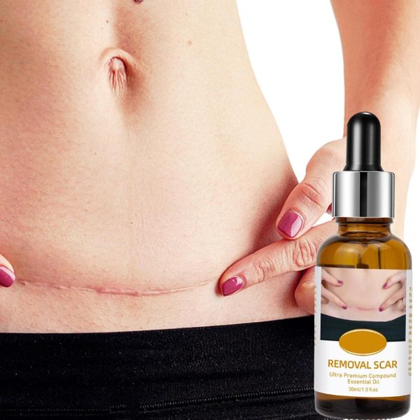 Acne Scar Removal Rejuvenation Serum | Scar, C Section & Stretch Mark Removal Oil For Women