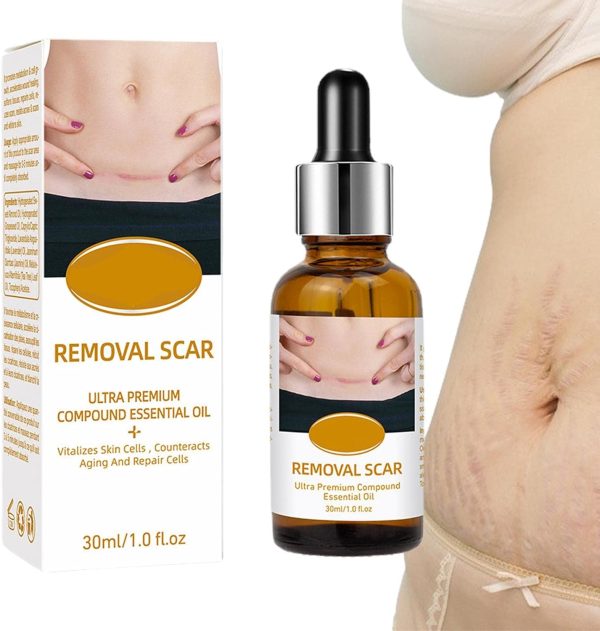 Acne Scar Removal Rejuvenation Serum | Scar, C Section & Stretch Mark Removal Oil For Women