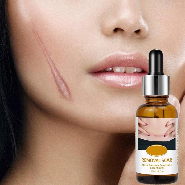 Acne Scar Removal Rejuvenation Serum | Scar, C Section & Stretch Mark Removal Oil For Women