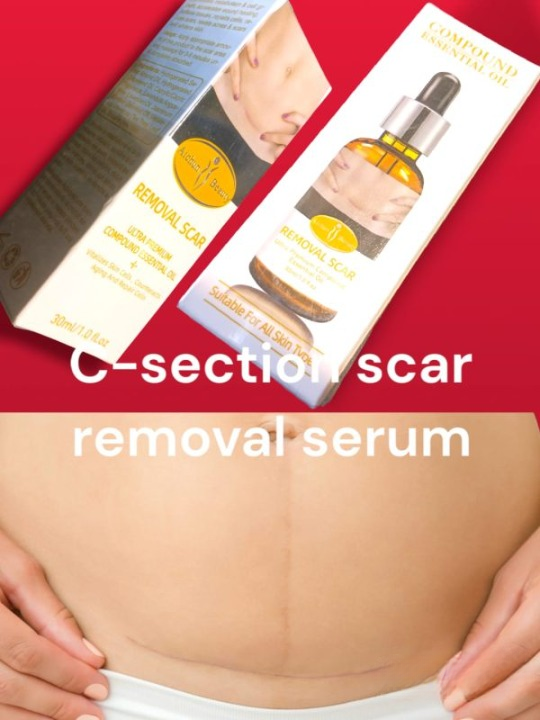 Acne Scar Removal Rejuvenation Serum | Scar, C Section & Stretch Mark Removal Oil For Women