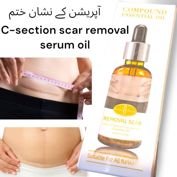 Acne Scar Removal Rejuvenation Serum | Scar, C Section & Stretch Mark Removal Oil For Women