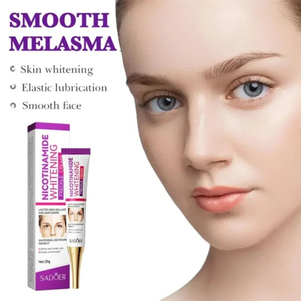 Nicotinamide Whitening Freckles Cream Remove Melasma Dark Spot Acne Marks Lightening Melanin Brightens Skin Tone Face Skin Care